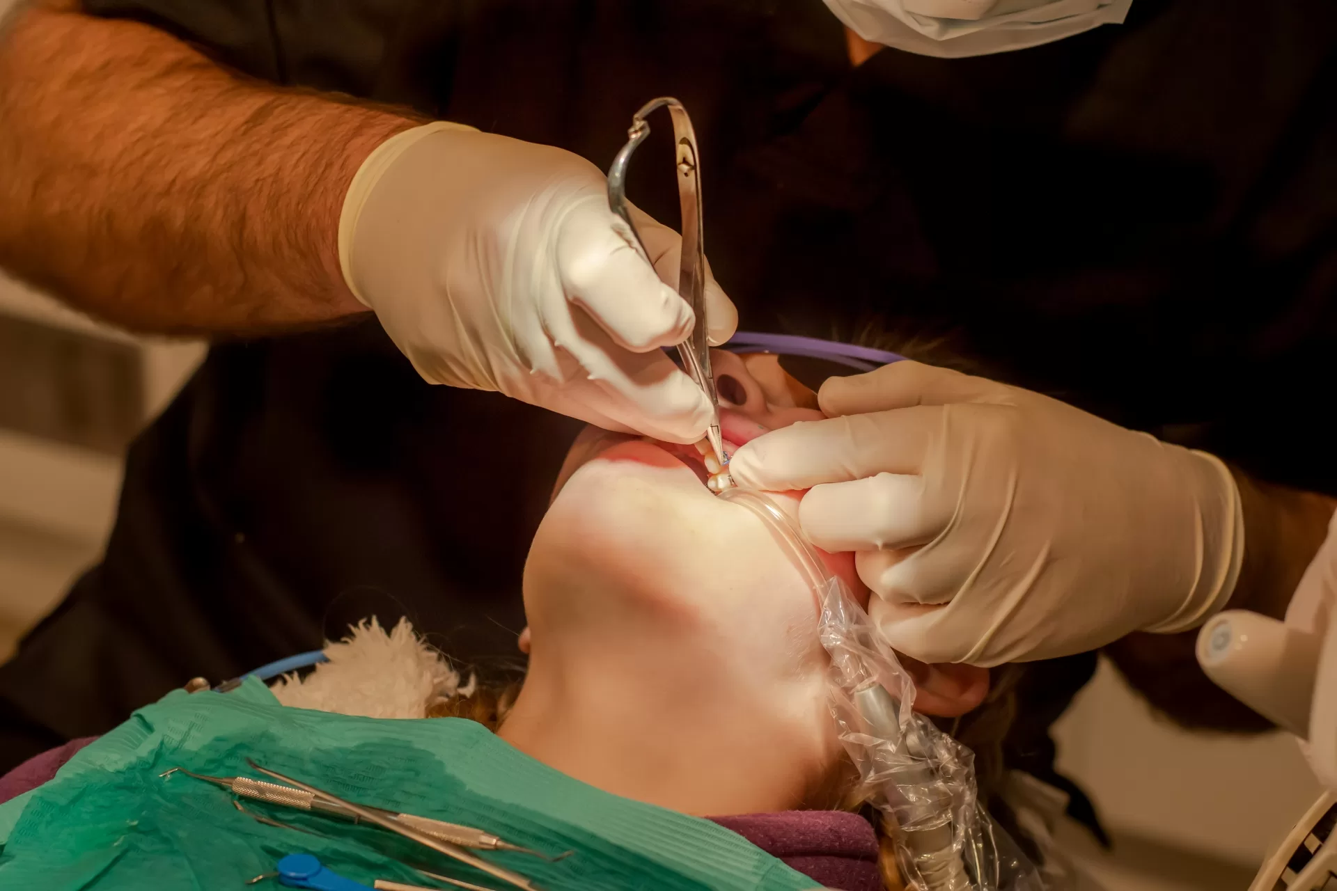 A dentist at Ridge Oral Surgery uses a dental instrument to extract a wisdom tooth from a patient's mouth.