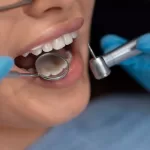 A close up of a dentist holding instruments near a patients mouth.