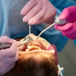 Two dental professionals perform a scaling and polishing procedure on a patient's teeth.