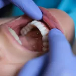 Oral Surgery