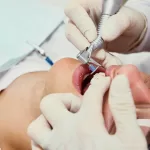 oral surgery