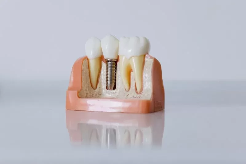 A dental tool used to demonstrate the human teeth structure, often a dental probe or mirror for detailed examination.