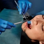 teeth extraction