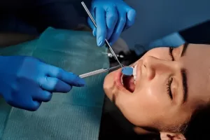 teeth extraction