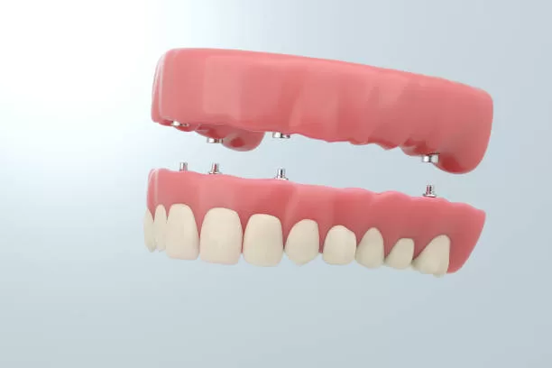 A model displaying an illustration of human teeth, used for educational purposes to show dental anatomy.