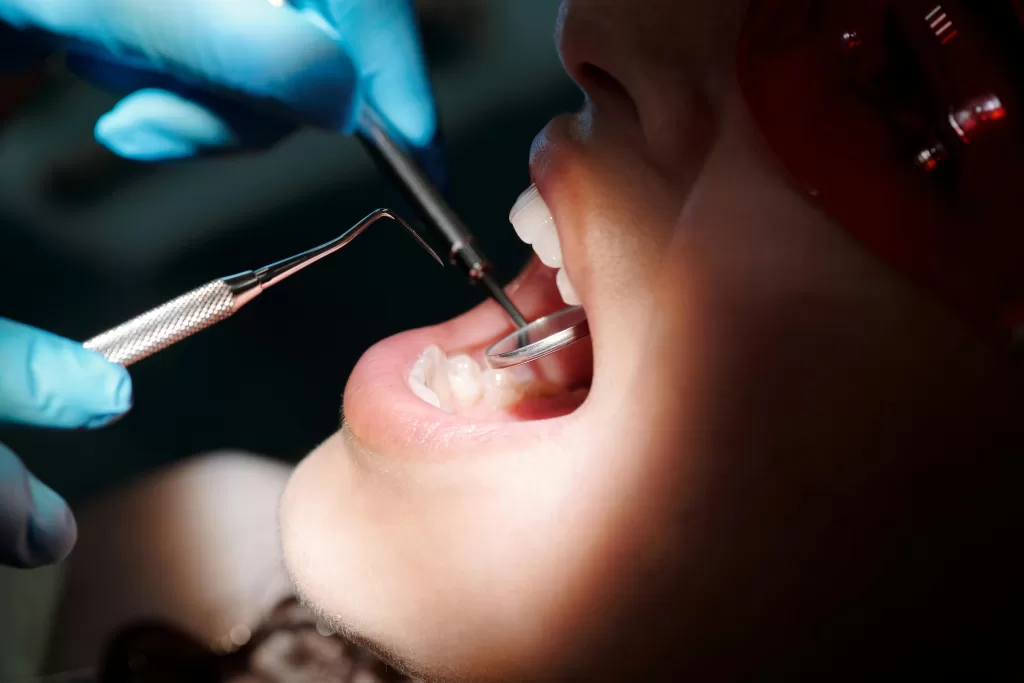 A close-up of a dentist, wearing blue gloves, examining a patient's teeth, emphasizing the importance of post-extraction checkups.