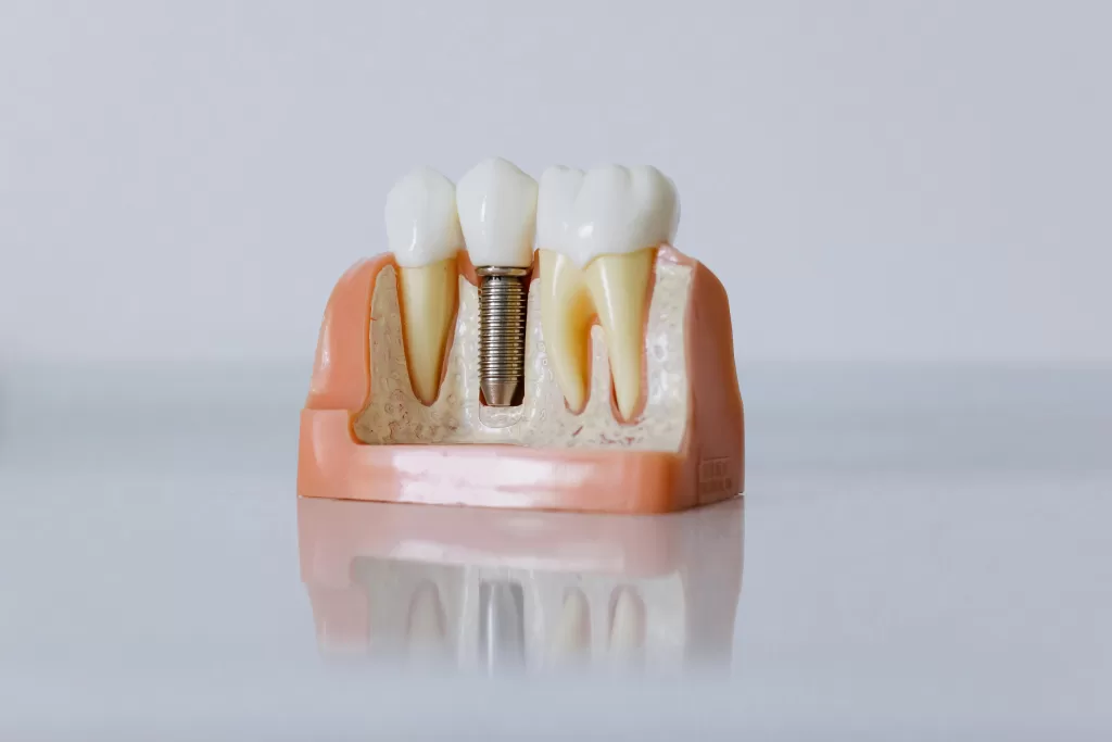 A model displaying an illustration of human teeth, showcasing the structure and alignment of a typical dental set.