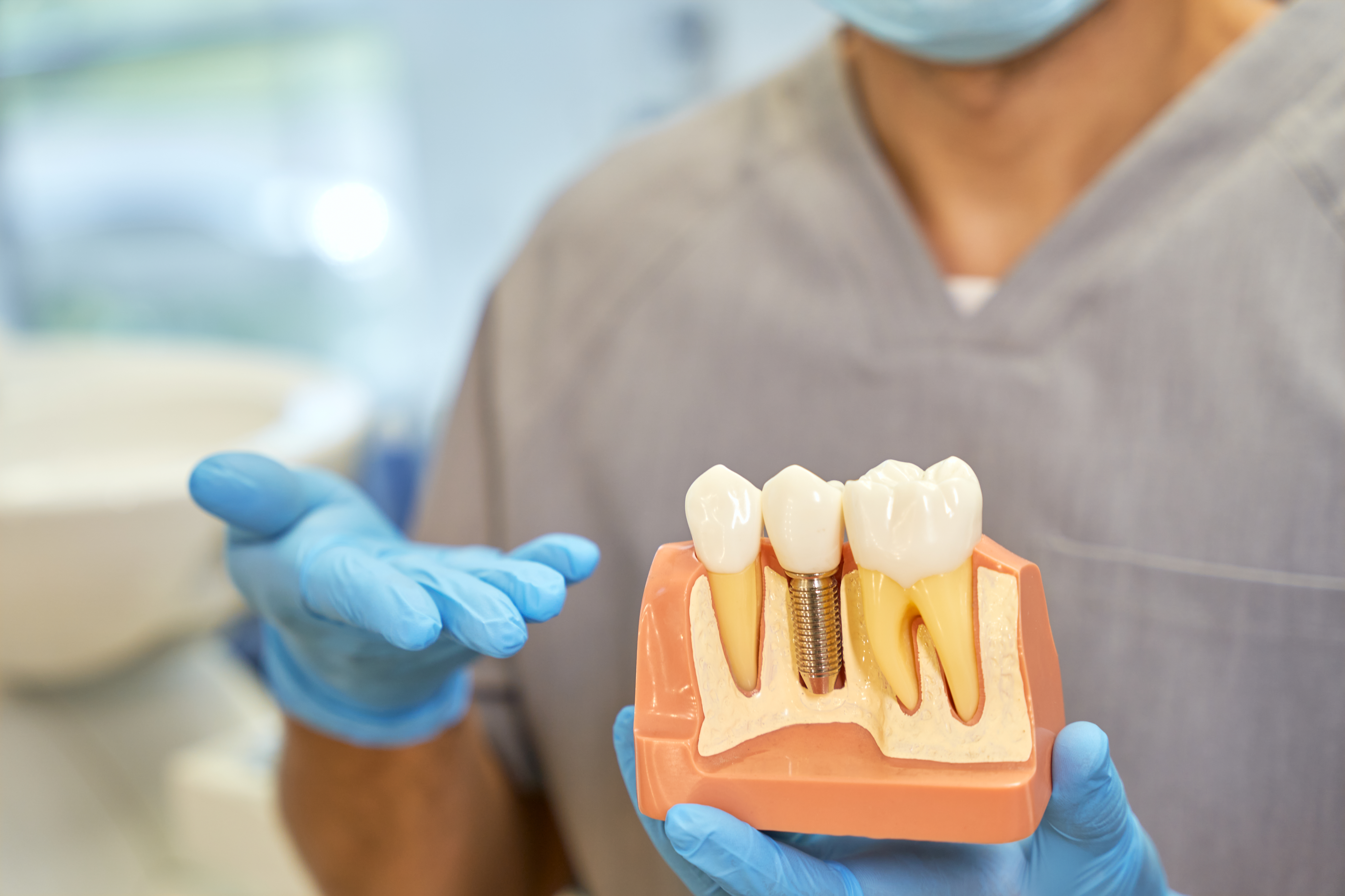 Dentist at Ridge Oral Surgery explaining a dental implant procedure to a patient using a tooth model during consultation.
