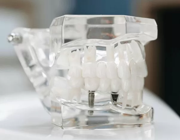 A dental tool used by dentists that depicts the structure of human teeth, providing detailed visualization for treatment.