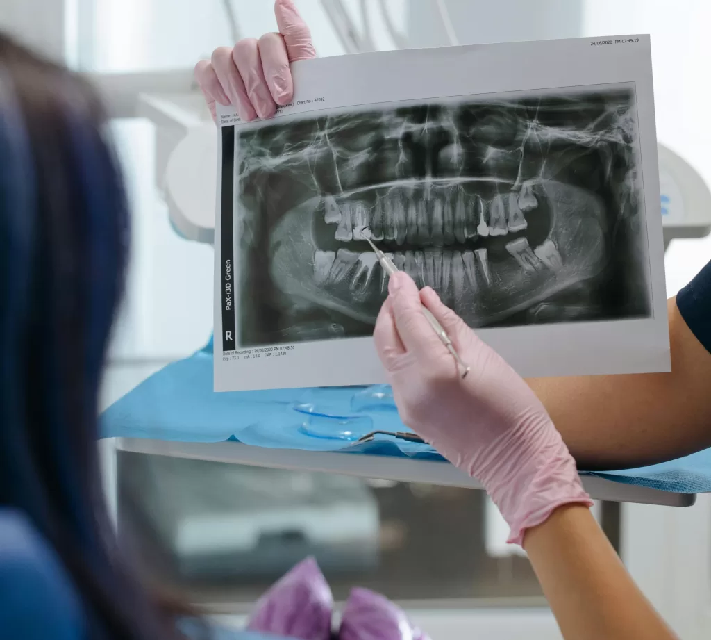 A dentist showing an X-ray of human teeth to a patient during a dental consultation in a modern clinic.