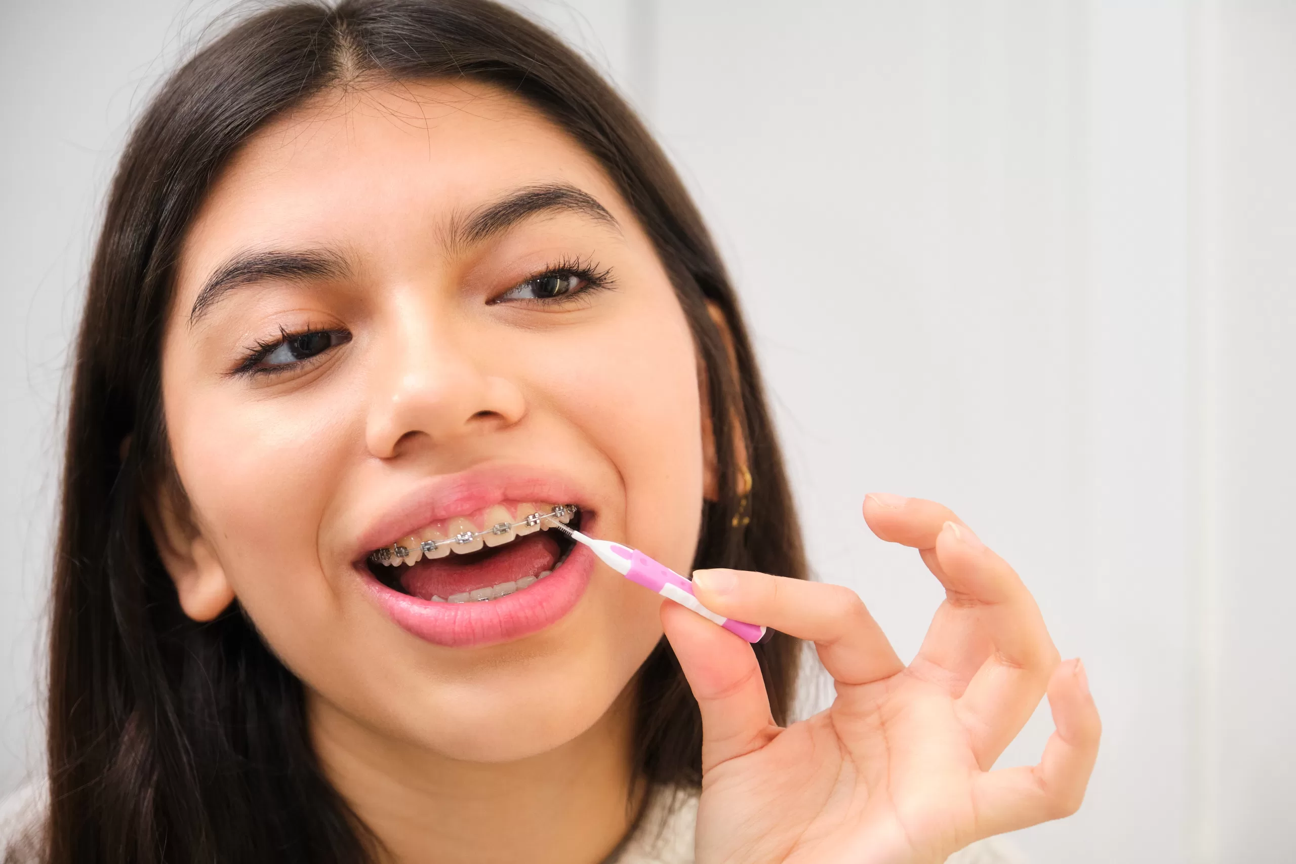 A girl cleaning her braces with interdental brush to maintain good oral hygiene.