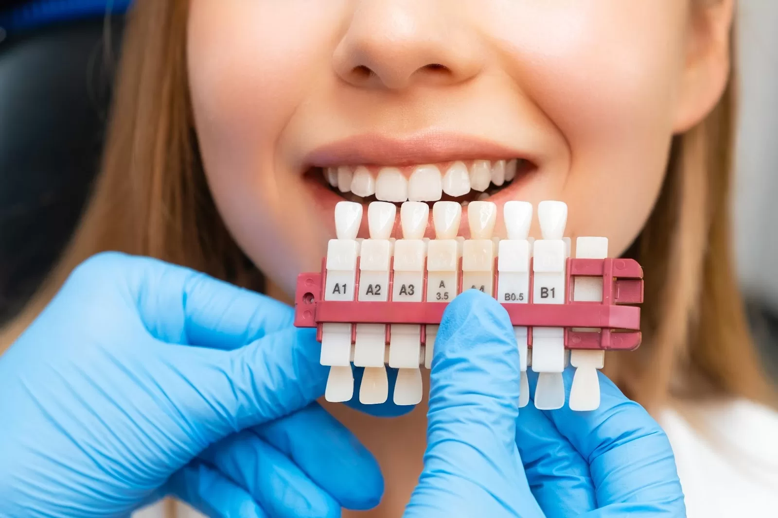 A lady deciding which shade should her teeth be as she decided to go under teeth whitening procedure.