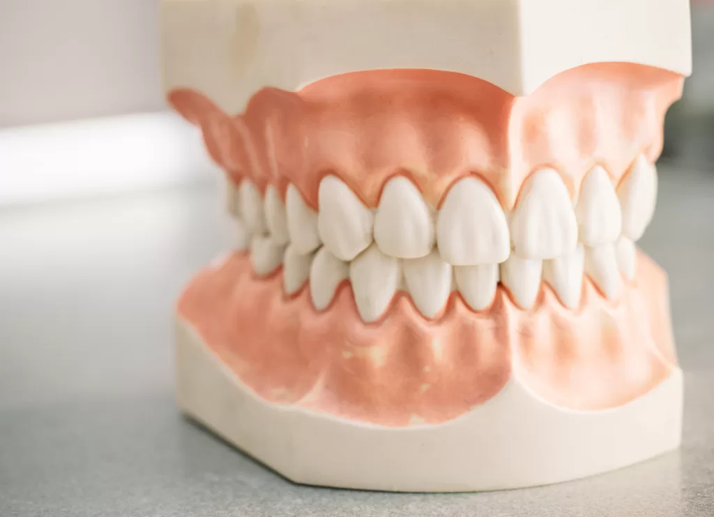 A model of a full set of dentures, emphasizing the importance of preventing gum disease for denture wearers.