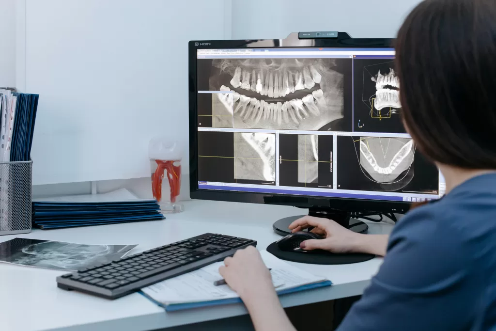 Doctor examining x-rays of teeth for surgery