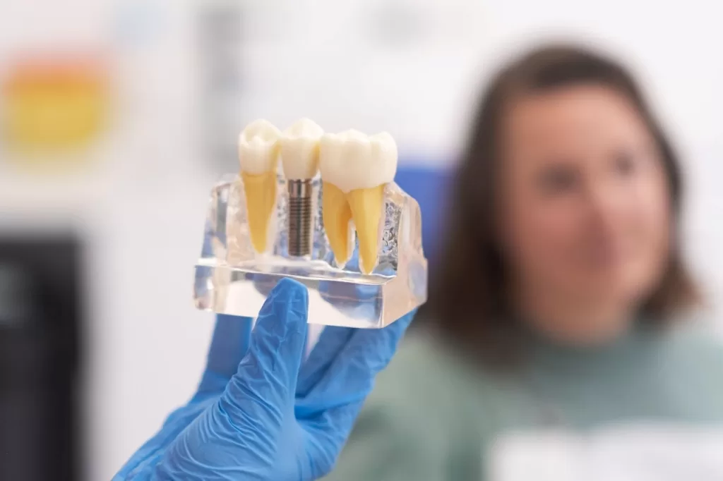 A close-up of a dental model demonstrating the placement of Zirconia Implants to replace missing teeth.