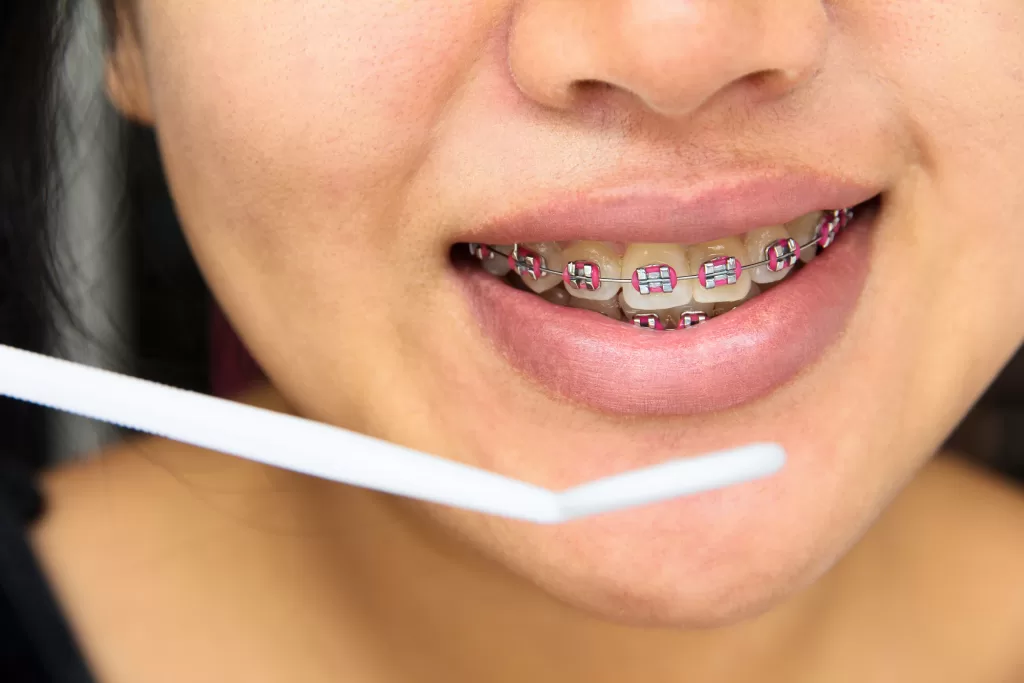 A girl cleaning her braces with tools for proper oral hygiene.