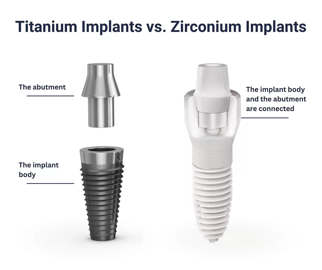 A brief diagram showing the differences between titanium and zirconia implants.