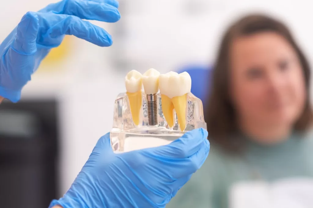 Model of zirconia implants held by a dental professional, showing implant structure and placement.