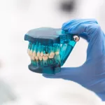 A gloved hand holds a blue dental model, highlighting the placement of zirconia implants for tooth replacement.