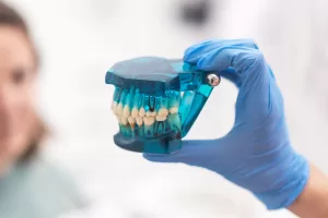 A gloved hand holds a blue dental model, highlighting the placement of zirconia implants for tooth replacement.