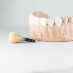 Close-up on plaster model of artificial jaw and dental implant on the white background