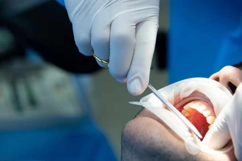 Dentist using dental tools to examine a patient’s teeth during socket preservation at Ridge Oral Surgery in New Jersey.