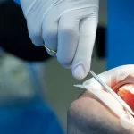 Dentist using dental tools to examine a patient’s teeth during socket preservation at Ridge Oral Surgery in New Jersey.