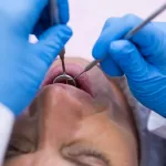 Close-up of an oral surgeon performing a dental procedure on a patient in a clinical setting.
