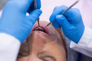 Close-up of an oral surgeon performing a dental procedure on a patient in a clinical setting.
