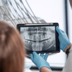 Oral surgeon reviewing digital dental X-rays with a patient during a consultation at Ridge Oral Surgery in Summit.