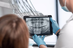 Oral surgeon reviewing digital dental X-rays with a patient during a consultation at Ridge Oral Surgery in Summit.