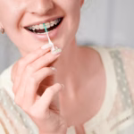 Woman with braces flossing her teeth with an interdental brush.