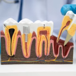 Dental tooth anatomy model showing tooth extraction and root structure for oral surgery education.